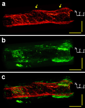 Image: The image at the bottom is a composite of the first two taken of a rabbit esophagus in vivo (Photo courtesy of Qifa Zhou).